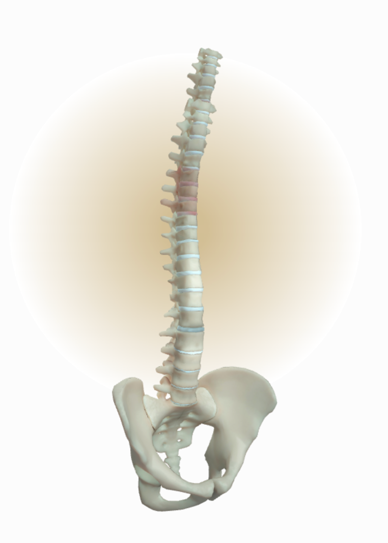 Skeletal changes in nr-axSpA