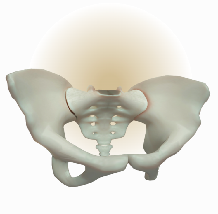 Skeletal changes in the SIJs depicting inflammation, minor erosion, and joint space irregularities for nr-axSpA