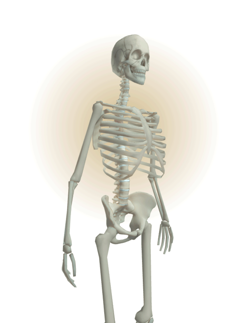 Inflammation with minor erosion and joint space irregularities in the SIJs along with inflammation in the spine