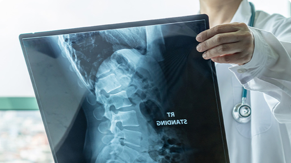 Male doctor reviewing a spinal x-ray.