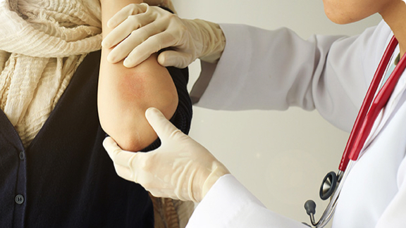 Health care professional inspecting red patch of skin on the arm of a patient.